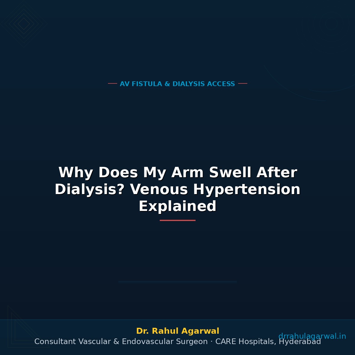Why Does My Arm Swell After Dialysis? Venous Hypertension Explained