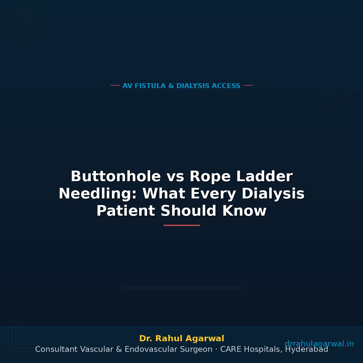Buttonhole vs Rope Ladder Needling: What Every Dialysis Patient Should Know
