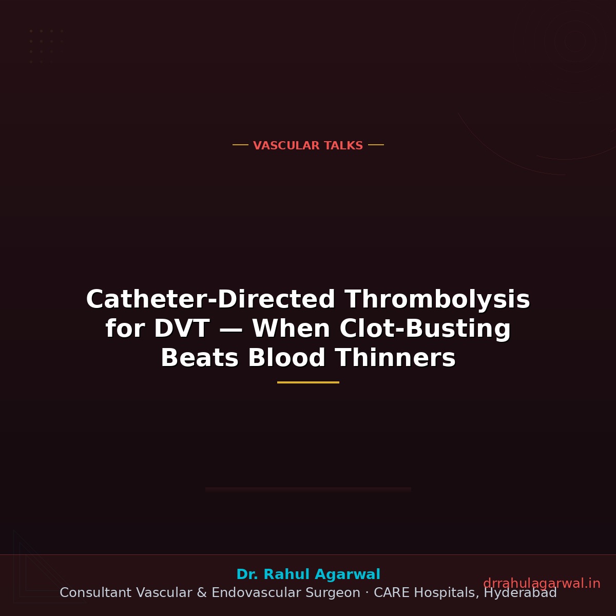 Catheter-Directed Thrombolysis for DVT — When Clot-Busting Beats Blood Thinners