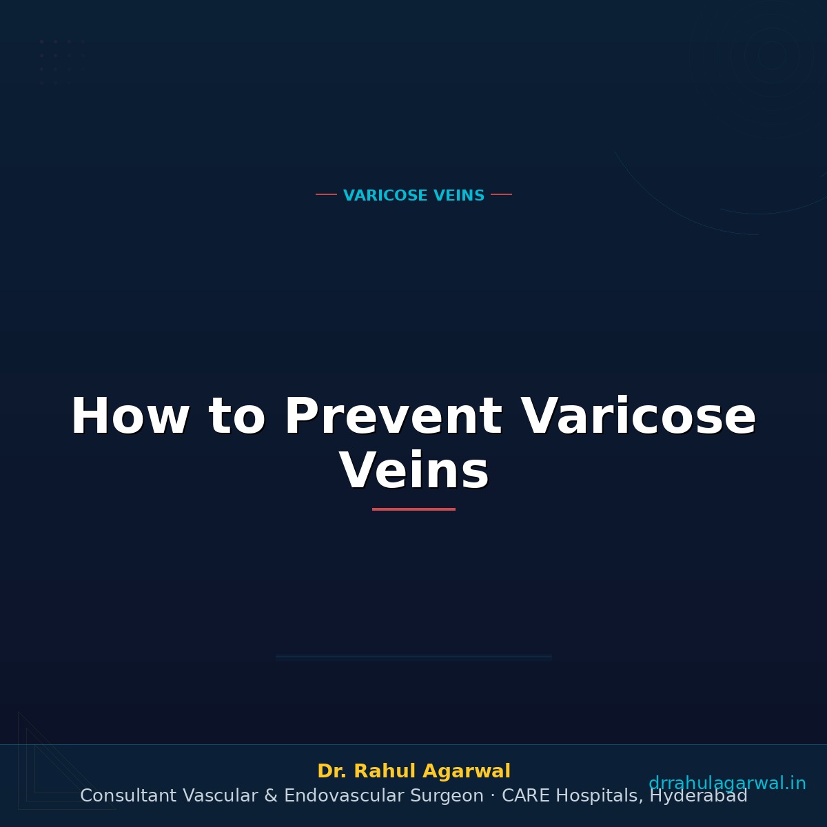 How to Prevent Varicose Veins