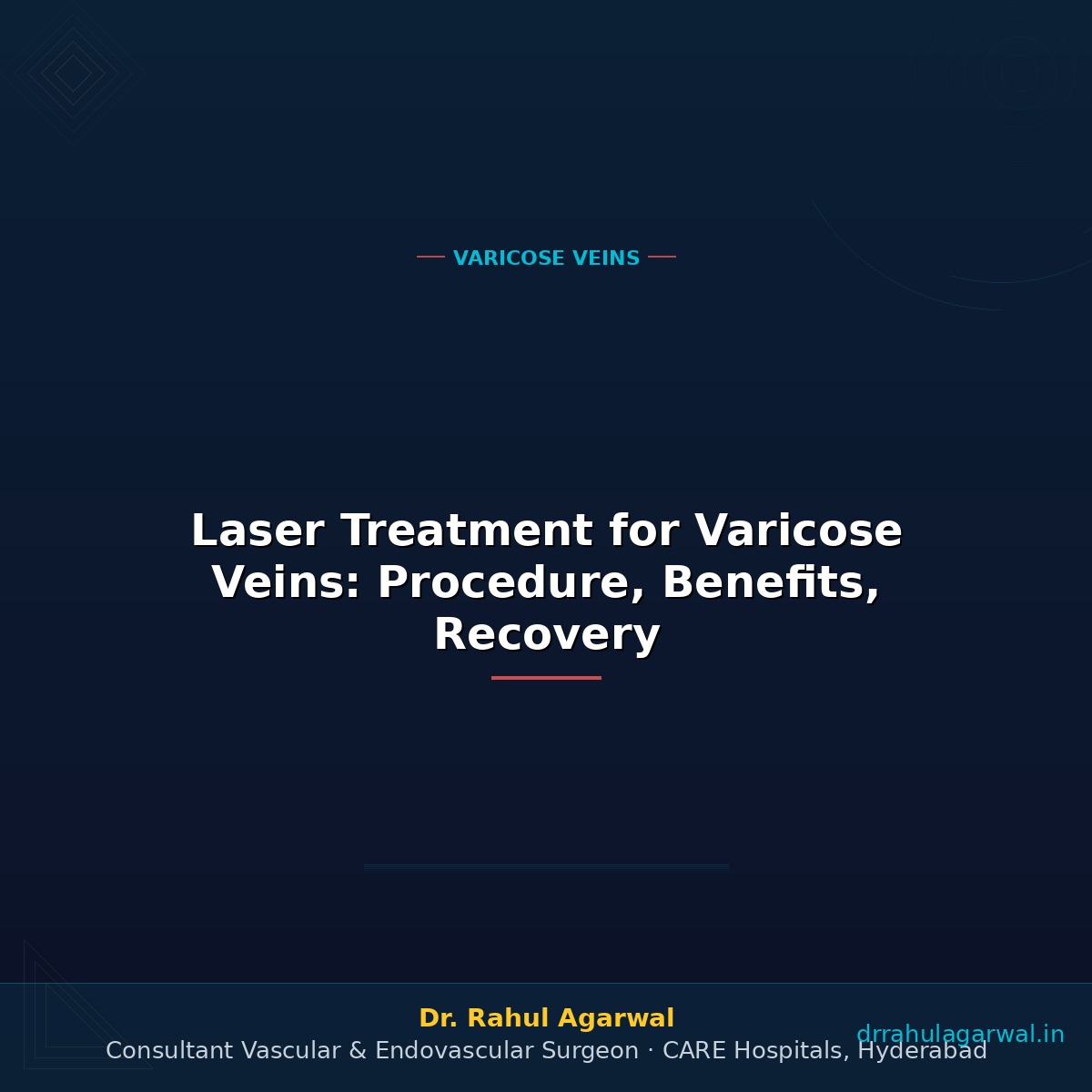 Laser Treatment for Varicose Veins: Procedure, Benefits, Recovery