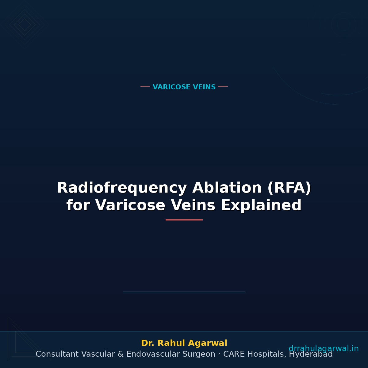 Radiofrequency Ablation (RFA) for Varicose Veins Explained