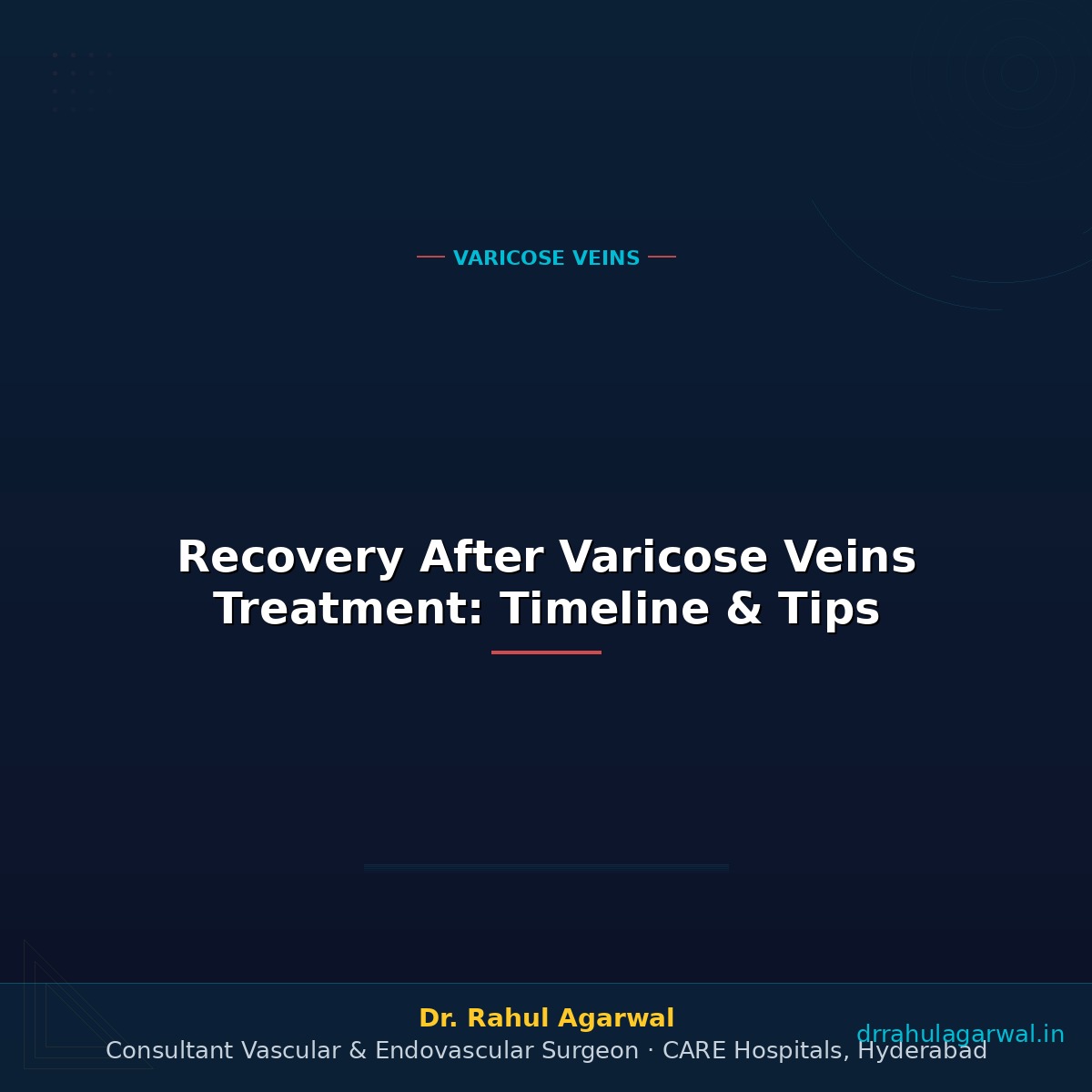 Recovery After Varicose Veins Treatment: Timeline & Tips