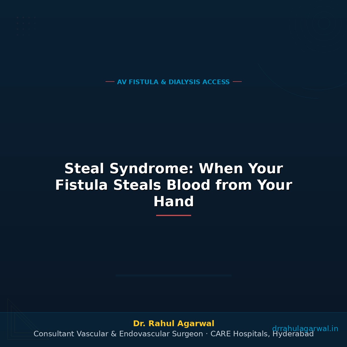 Steal Syndrome: When Your Fistula “Steals” Blood from Your Hand