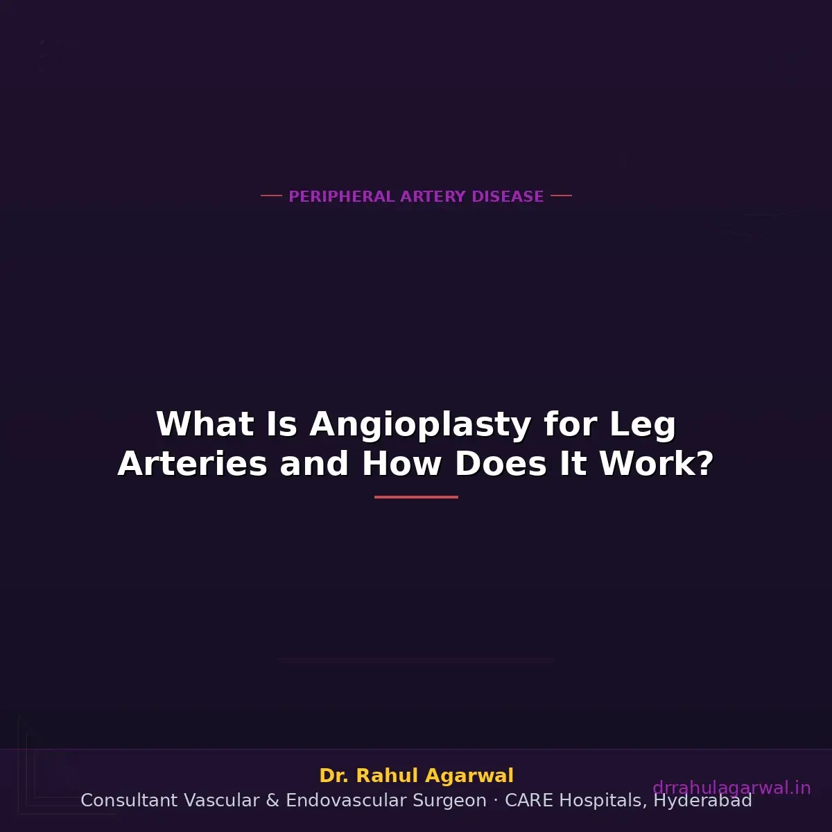 Angioplasty for blocked leg arteries — procedure stenting recovery — Dr Rahul Agarwal Hyderabad